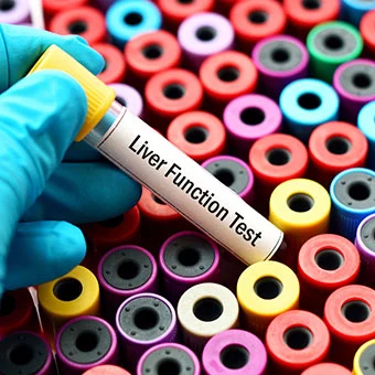 Liver Function Testing